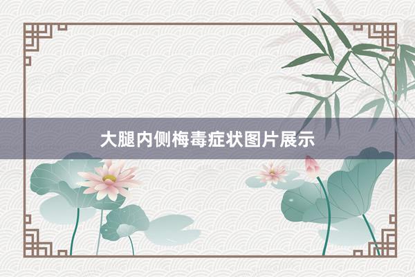 大腿内侧梅毒症状图片展示